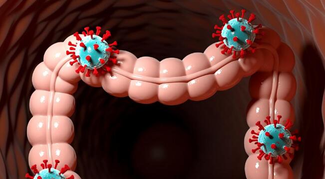 江苏南通出现霍乱确诊病例